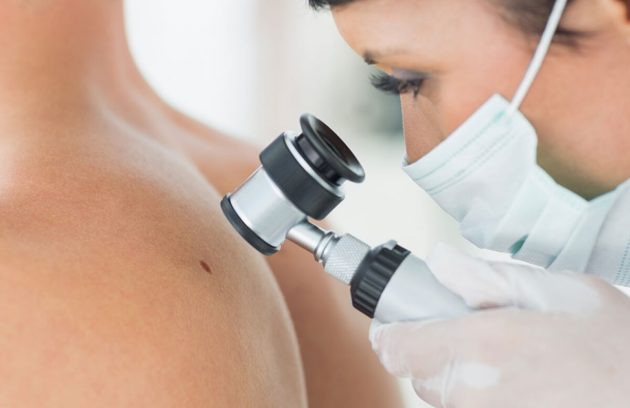 mladeži i bradavice na koži