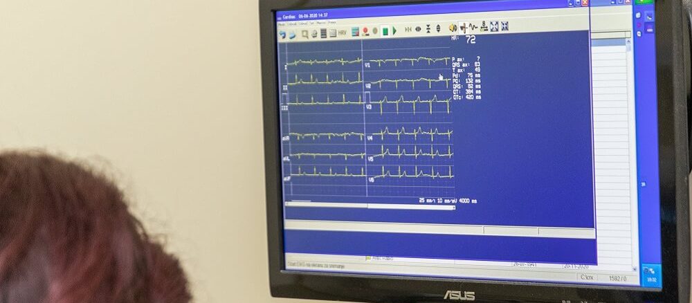 kardiovaskularno zdravlje